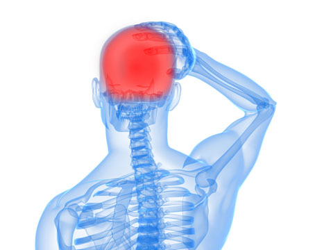 Digram showing head pain